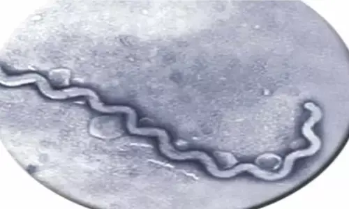 Leptospirosis: Bacterial disease Leptospirosis has killed more than 100 people in UP, know symptoms, causes and prevention