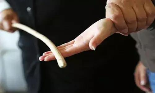 Indore: निर्मोही शिक्षक का अत्याचार, बच्ची का जोर से मरोड़ दिया हाथ, हो गया फ्रैक्चर, थाने पहुंचे परिजन