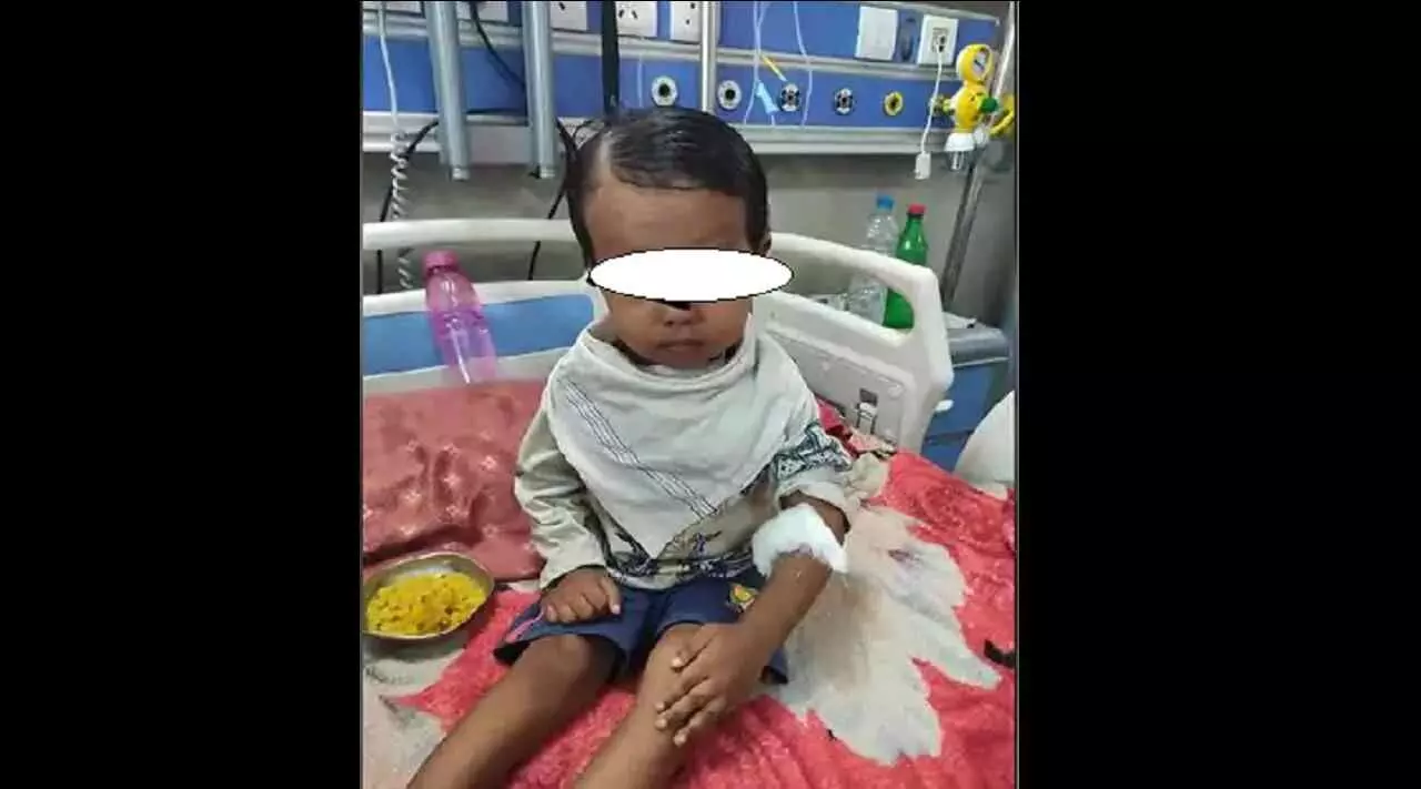 दो वर्ष के बच्चे की किडनी से निकली पथरी, डॉक्टरों ने दी नई जिंदगी