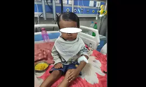 दो वर्ष के बच्चे की किडनी से निकली पथरी, डॉक्टरों ने दी नई जिंदगी