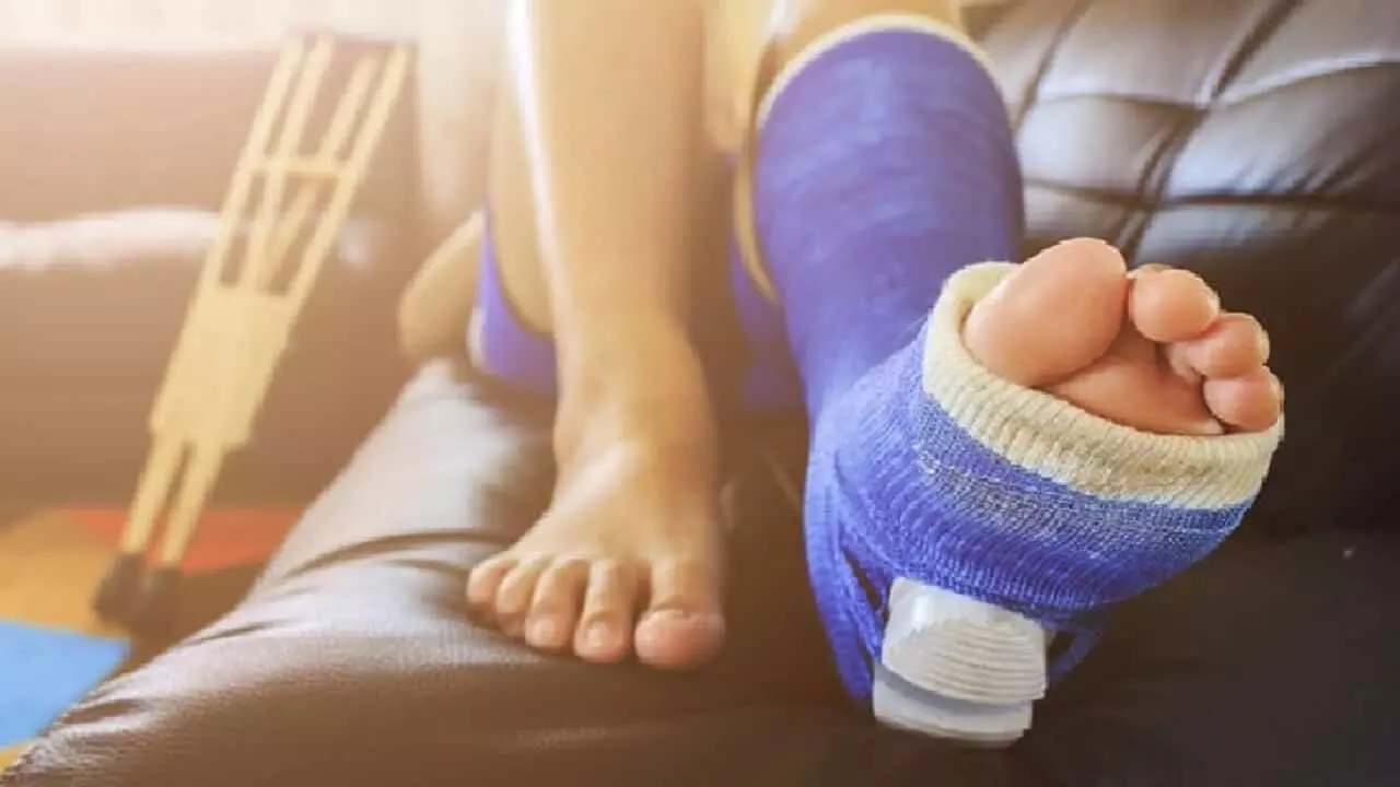 GOOD NEWS: अब केवल 3 दिन में जुड़ेगी शरीर की टूटी हुई हड्डी, नेल्सकान तकनीक बनी सहायक