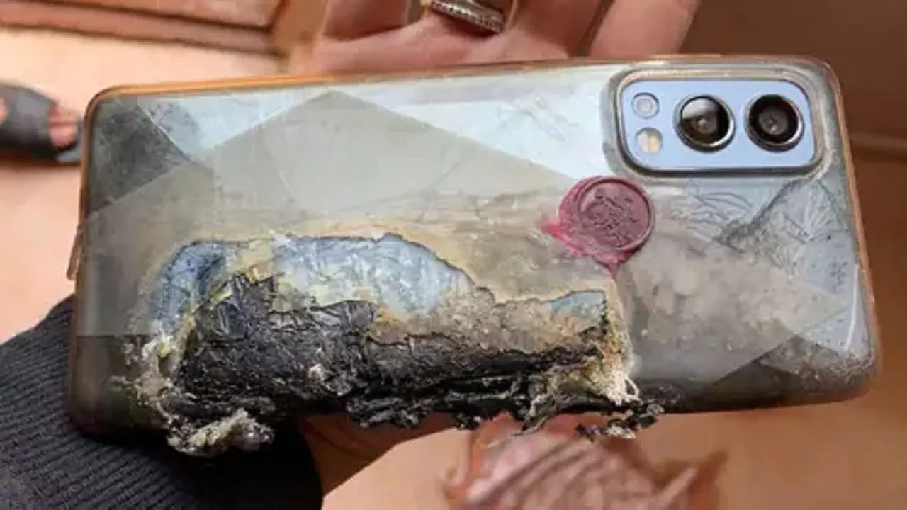 OnePlus Nord 2 मोबाइल ब्लास्ट के बाद कंपनी ने घायल यूजर को दिया मुआवज़ा, फोन फटने से जांघ का का हिस्सा जल गया था