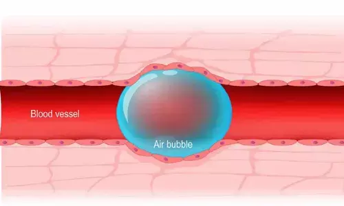 खाली इंजेक्शन लगाने से इंसान के शरीर को हो सकता है भारी नुकसान, जाने कैसे?