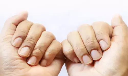 नाखूनों के रंग में हो रहा है बदलाव तो हो जाएं सावधान, हो सकता है इन गंभीर बीमारियों का संकेत