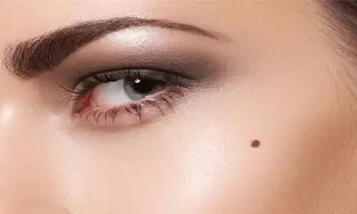 Mole On Body: इन जगहों में है तिल तो प्यार में मिलेगा धोखा, शादी के बाद भी जिंदगी हो जाएगी नरक, जानिए! Mole On Body: इन जगहों में है तिल तो प्यार में मिलेगा धोखा, शादी के बाद भी जिंदगी हो जाएगी नरक, जानिए!