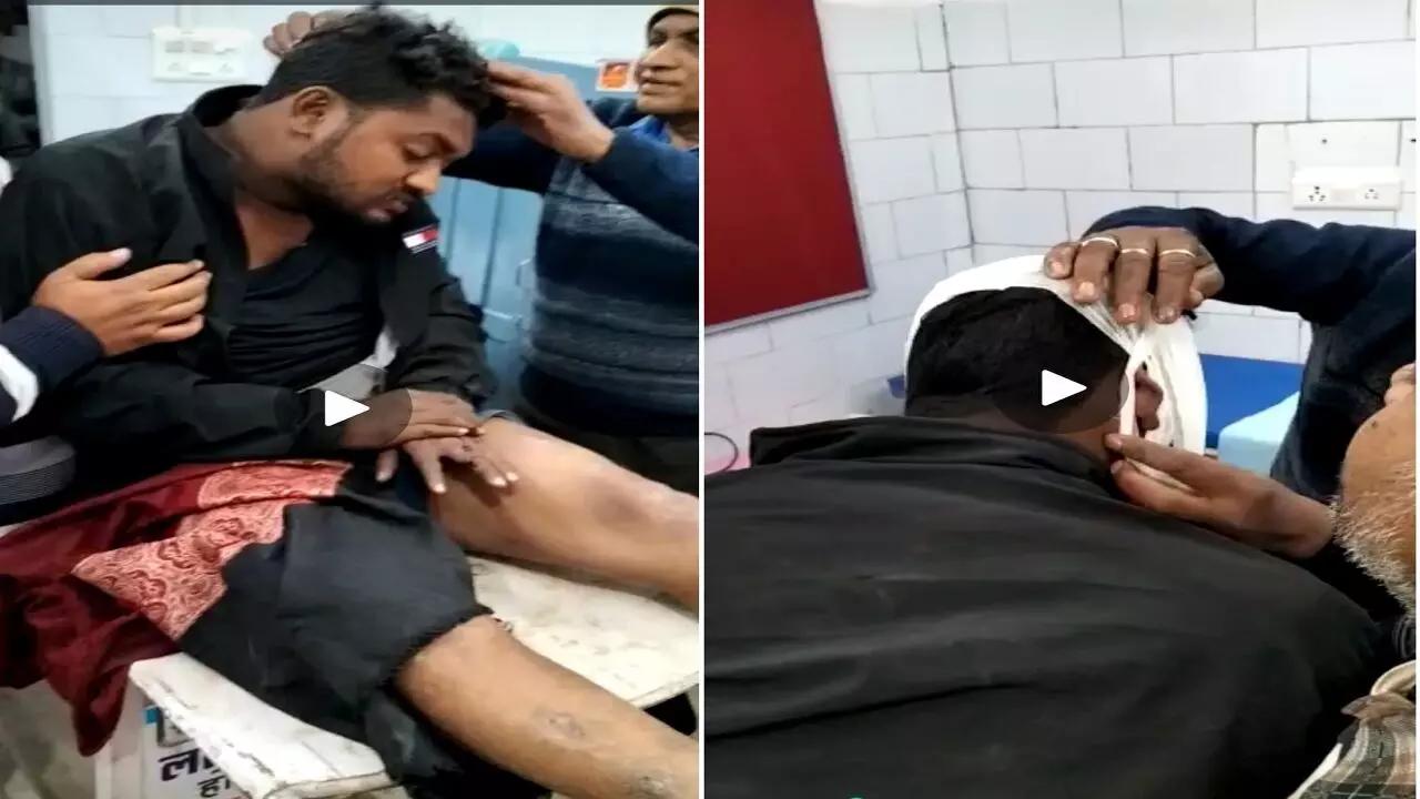 Rewa News: फल विक्रेता 2 भाईयों पर हमला कर किया लहूलुहान, आधा दर्जन हमलावरों ने दिया घटना को अंजाम Rewa News: फल विक्रेता 2 भाईयों पर हमला कर किया लहूलुहान, आधा दर्जन हमलावरों ने दिया घटना को अंजाम