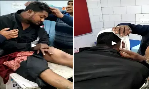 Rewa News: फल विक्रेता 2 भाईयों पर हमला कर किया लहूलुहान, आधा दर्जन हमलावरों ने दिया घटना को अंजाम