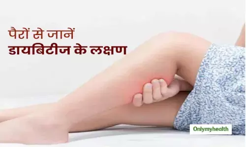 अधिक शुगर लेवल का संकेत देते हैं पैर : Adhik Suger Level Ka Sanket Dete Hai Pair