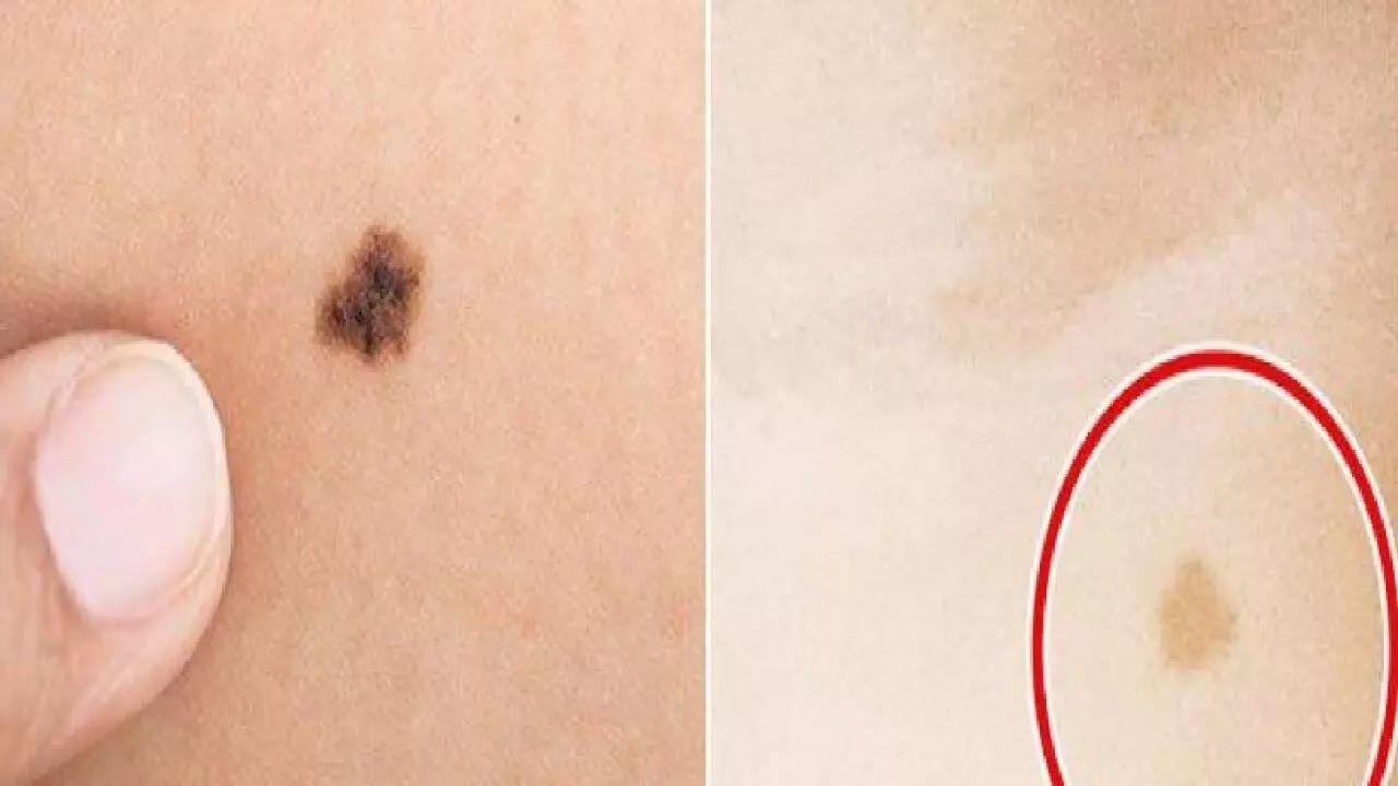 अगर आपके शरीर में है इस जगह तिल तो आप तुरंत बन जाएंगे धनवान, भाग्योदय इस तरह होगा की आपके पीछे होंगे बड़े-बड़े अमीर, जानिए! अगर आपके शरीर में है इस जगह तिल तो आप तुरंत बन जाएंगे धनवान, भाग्योदय इस तरह होगा की आपके पीछे होंगे बड़े-बड़े अमीर, जानिए!