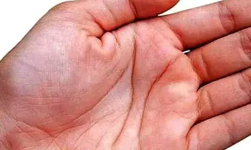अगर हाँथ में बना है ऐसा निशान तो आ सकता है हार्ट अटैक, ऐसे चेक करे