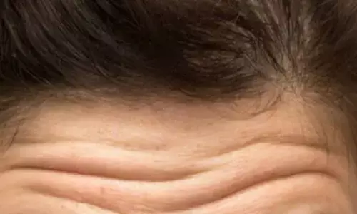 जिस व्यक्ति के माथे पर होती है ऐसी लकीर, उसके अंदर होती है दैवीय शक्ति, भगवान का दूसरा रूप होते है जिस व्यक्ति के माथे पर होती है ऐसी लकीर, उसके अंदर होती है दैवीय शक्ति, भगवान का दूसरा रूप होते है