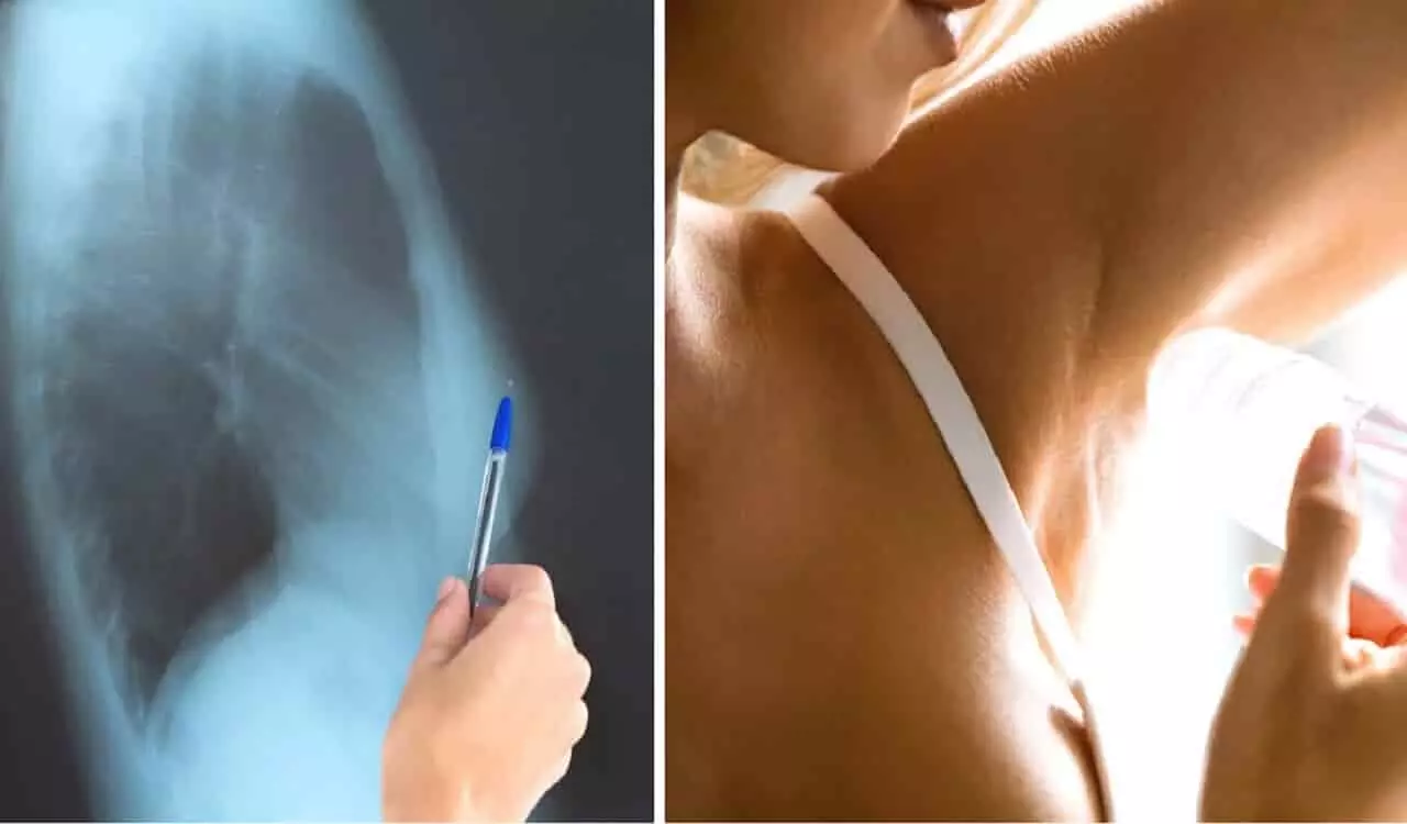 Breast Cancer And Deodorant: क्या डियोड्रेंट लगाने से होता है ब्रेस्ट कैंसर