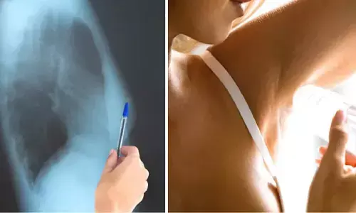 Breast Cancer And Deodorant: क्या डियोड्रेंट लगाने से होता है ब्रेस्ट कैंसर