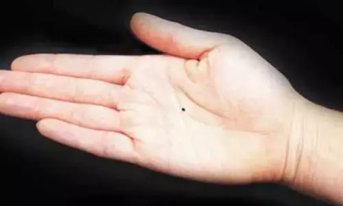 जिनके हाँथ में है ऐसा तिल उन्हें शादी के बाद भी नहीं मिलता सुख, पार्टनर के प्यार के लिए तरसते रहते है