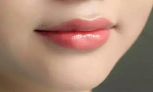 इन उपायों को अपना कर आप दूर कर सकते अपने होठों का कालापन इन उपायों को अपना कर आप दूर कर सकते अपने होठों का कालापन