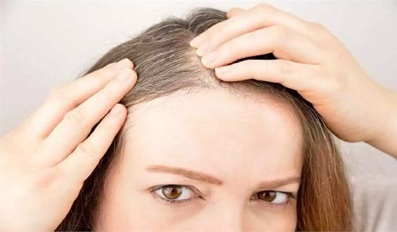 Food For Hair Fall: गंजेपन से हैं परेशान तो अपनी डाइट में शामिल करें ये चीजें