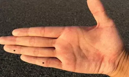 Mole Of Palm: अगर आपके हाँथ में है ऐसा तिल तो आपके साथ भविष्य में होने वाला है कुछ ऐसा, जानिए!