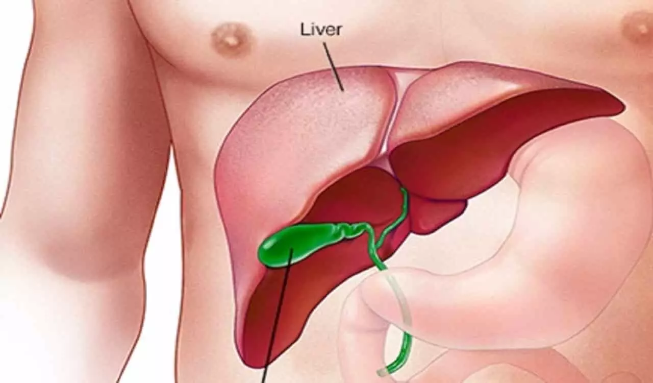 Fatty Liver: इन लक्षणों को भूलकर भी ना करें नजरअंदाज हो सकता है आपके लीवर को खतरा