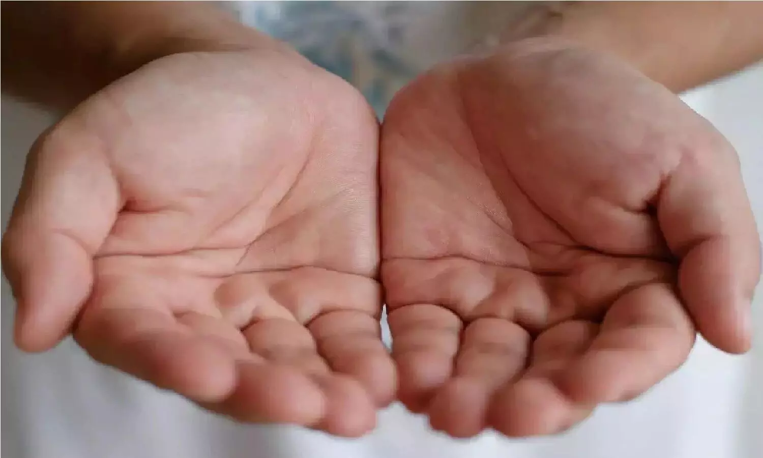 अगर आपकी हथेली में है ऐसे निशान तो होने वाली है गंभीर बीमारी, जानिए!