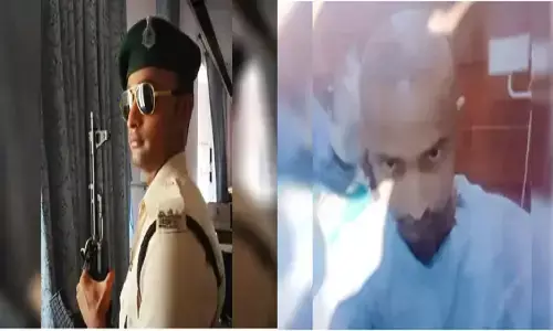 Death By hair transplant: हेयर ट्रांसप्लांट के बाद जवान की मौत, 11 मई को शादी थी Death By hair transplant: हेयर ट्रांसप्लांट के बाद जवान की मौत, 11 मई को शादी थी