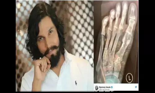 bollywood actors injury bollywood actors injury