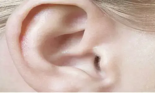 जिनके कान में होते है ऐसे बाल उनका मालामाल बनना तय, चौतरफा होगी प्रापर्टी