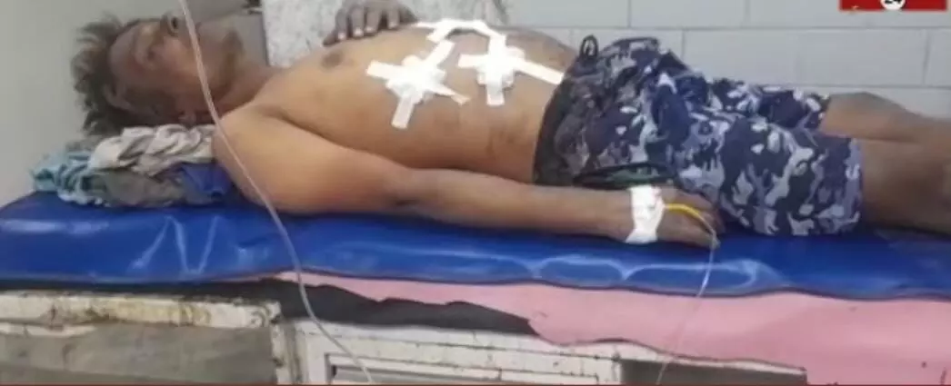 Rewa: 4 सौ रूपए के लिए श्रमिक पर चाकू से हमला, आरोपियों को तलाश रही पुलिस