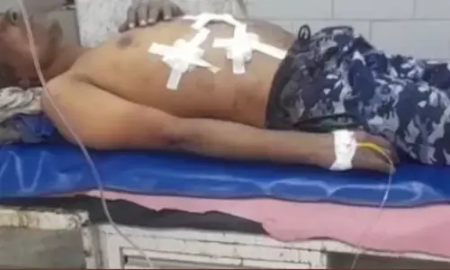 Rewa: 4 सौ रूपए के लिए श्रमिक पर चाकू से हमला, आरोपियों को तलाश रही पुलिस Rewa: 4 सौ रूपए के लिए श्रमिक पर चाकू से हमला, आरोपियों को तलाश रही पुलिस