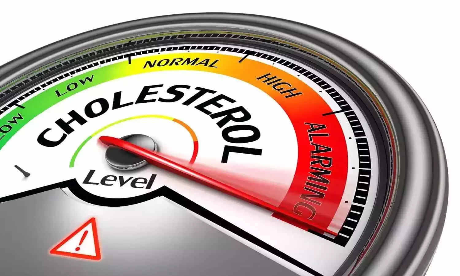 High Cholesterol Symptoms: हाई कोलेस्ट्रॉल होने के लक्षण पहचानें पैरों में होती हैं यें परेशानियां! ना करें नजरअंदाज