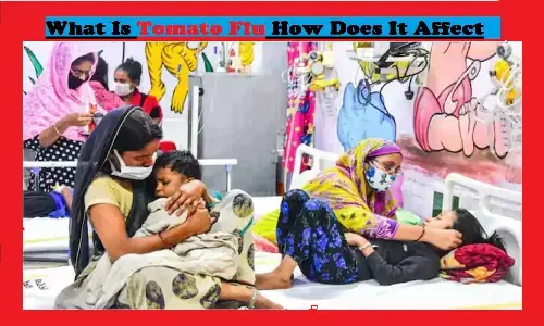 टोमेटो फ्लू क्या है: जो बच्चों को अपना शिकार बना रहा है, क्या Tomato Flu जान ले सकता है? टोमेटो फ्लू क्या है: जो बच्चों को अपना शिकार बना रहा है, क्या Tomato Flu जान ले सकता है?