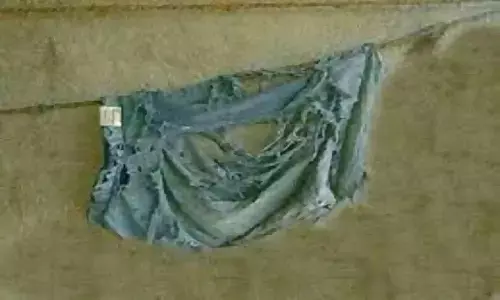 Underwear की एक्सपायरी डेट जानें, कितना खतरनाक हो सकता है पुराने अंडरवियर पहनना