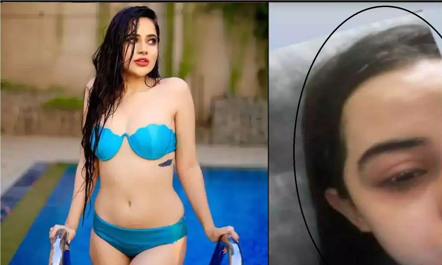 Urfi Javed: बुरी खबर! उर्फी जावेद का चेहरा बुरी तरह हुआ ख़राब, रोते हुए कहा किसी को मुँह दिखाने लायक नहीं रही