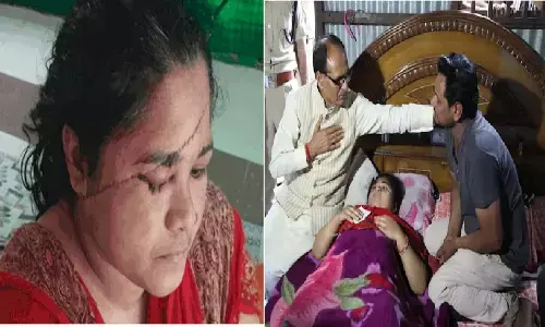 भोपाल ब्लेड कांड: सीएम चौहान ने पीड़िता सीमा से कठोर कार्रवाई का वादा किया, आरोपियों ने कई बार ब्लेड से हमला किया था भोपाल ब्लेड कांड: सीएम चौहान ने पीड़िता सीमा से कठोर कार्रवाई का वादा किया, आरोपियों ने कई बार ब्लेड से हमला किया था