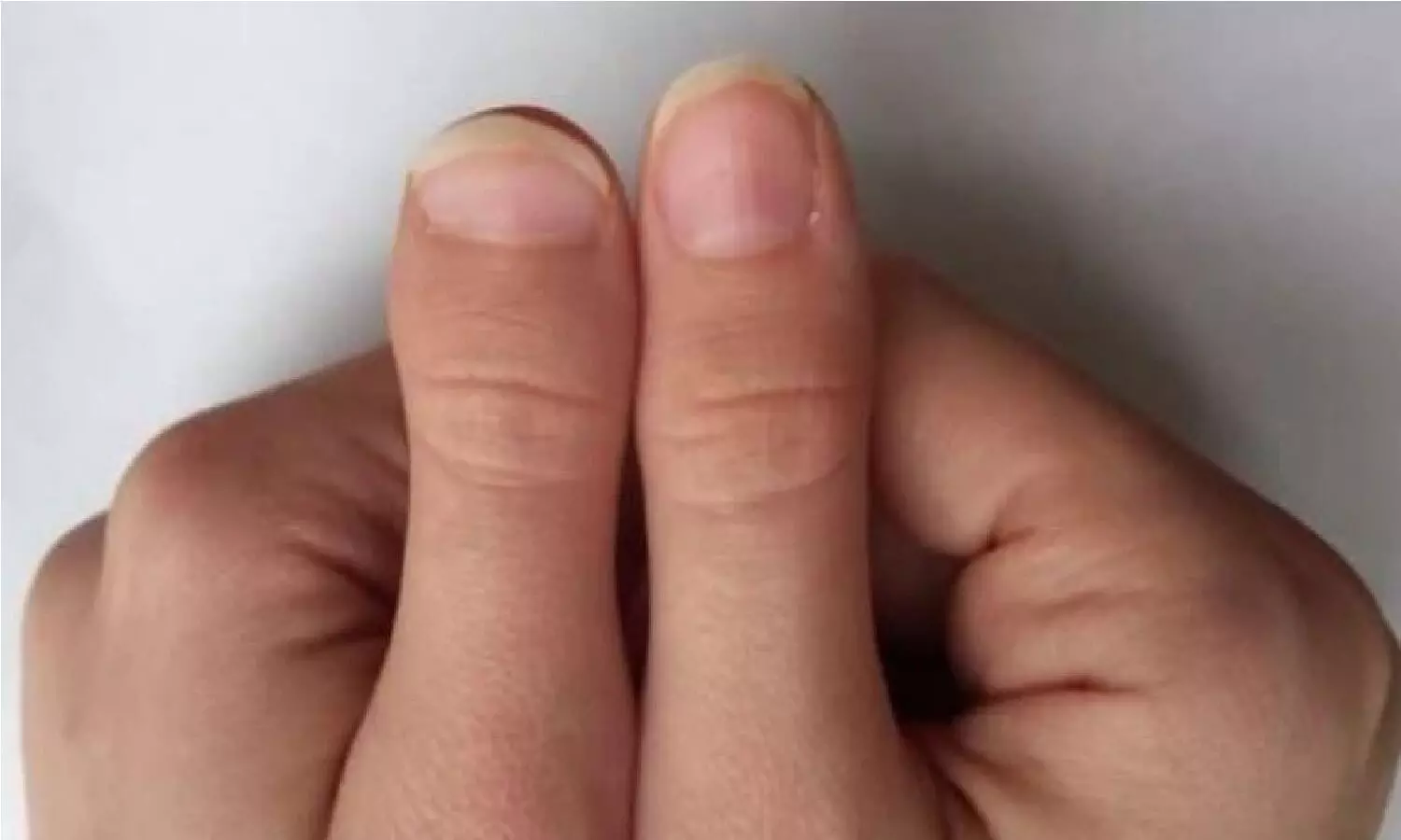 Palmistry For Thumb: अपने अंगूठे से जाने कैसी होगी आपकी किस्मत, हाँथ में पैसा होगा या जिंदगी भर रहेंगे गरीब