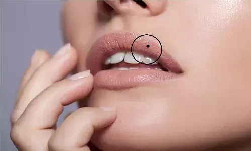 Mole On The Lips Of Women: जिन महिलाओं के होठों में होता है तिल, उनके बारे में जान आपकी बेचैनी बढ़ जाएगी Mole On The Lips Of Women: जिन महिलाओं के होठों में होता है तिल, उनके बारे में जान आपकी बेचैनी बढ़ जाएगी