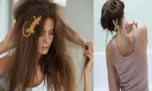 Lizard Hair Fall: यदि छिपकली गिर गई आपके बाल में तो कुछ घंटे बाद हो जाएगी आपकी मौत, साथ ही मचेगी परिवार में तबाही