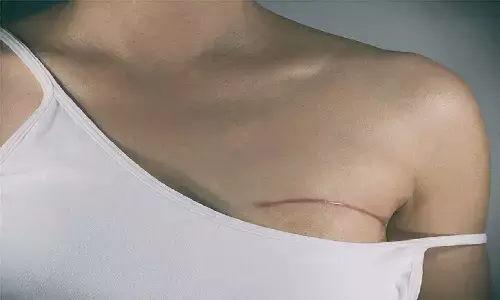 How To Avoid Breast Cancer: ब्रेस्ट कैंसर से बचने का ये रहा शानदार तरीका