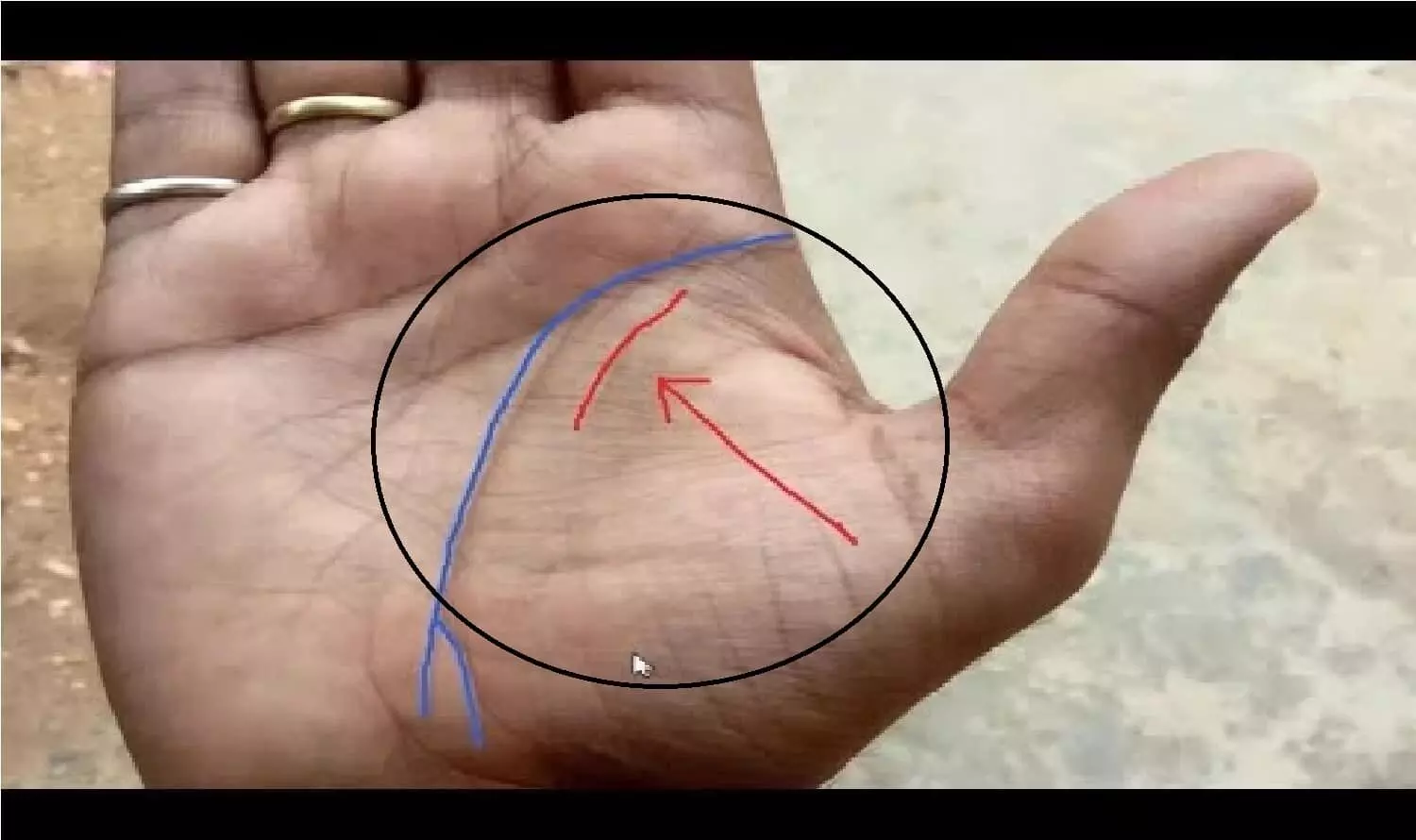 Mangal Rekha in Palm: अगर आपके हाँथ में है मंगल रेखा तो रातों-रात करोड़पति बनने से खुद भगवान भी नहीं रोक सकते