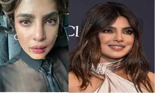 Priyanka Chopra को लगी भयंकर चोट, 4 महीने की बच्ची को छोड़ विदेश चली गई एक्ट्रेस, Nick Jonas परेशान.. Priyanka Chopra को लगी भयंकर चोट, 4 महीने की बच्ची को छोड़ विदेश चली गई एक्ट्रेस, Nick Jonas परेशान..