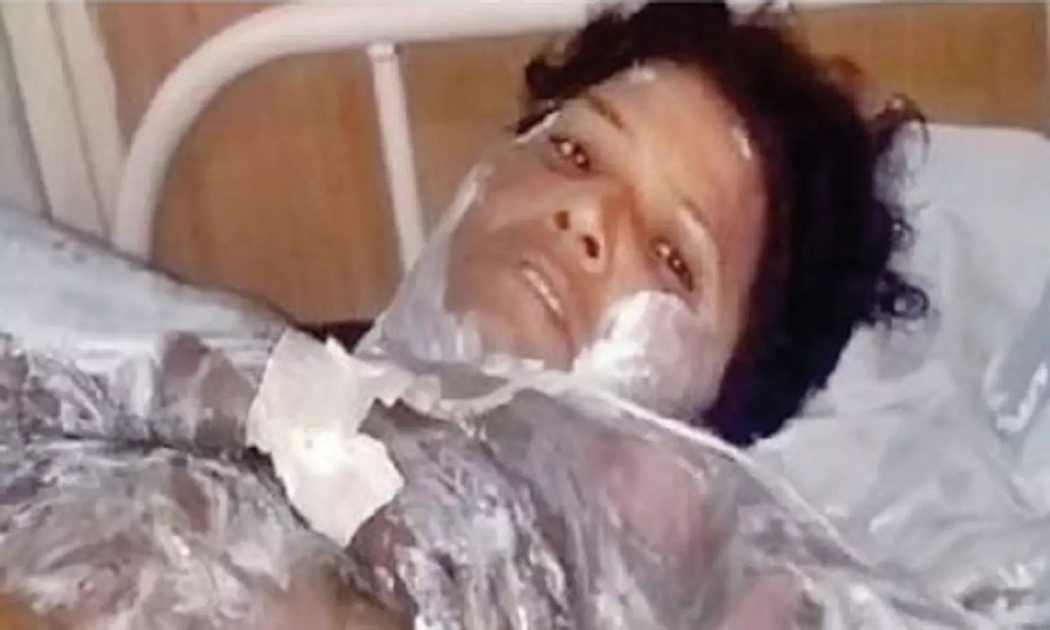 Tribal Woman Burnt Alive: गुना में डीजल डालकर आदिवासी महिला को जिंदा जलाया, वो चीखती-तड़पती रही, आरोपी बनाते रहे वीडियो