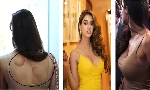 Disha Patani की पीठ की हुई ऐसी हालत, यूजर्स ने कहा- टाइगर के रातभर प्यार की निशानी है