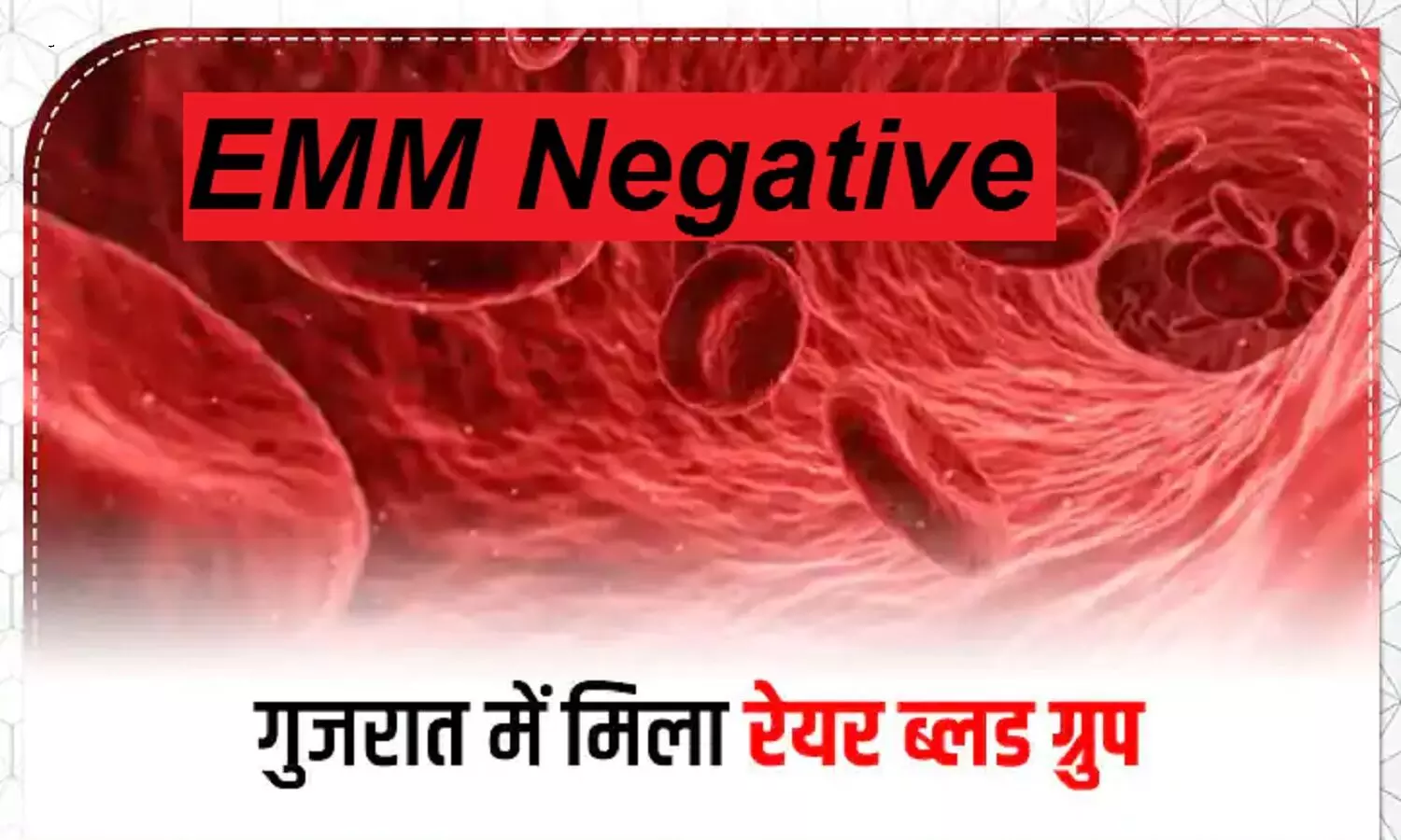 EMM Negative Blood Group: ऐसा ब्लड ग्रुप जो सिर्फ दुनिया के 10 लोगों में है, इनमे से एक केस गुजरात में मिला है