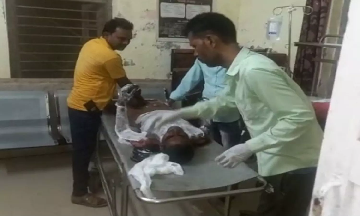 एमपी के पन्ना जिले में पेट्रोल डालकर युवक को जिंदा जलाया, जिंदगी-मौत के बीच जूझ रहा युवक