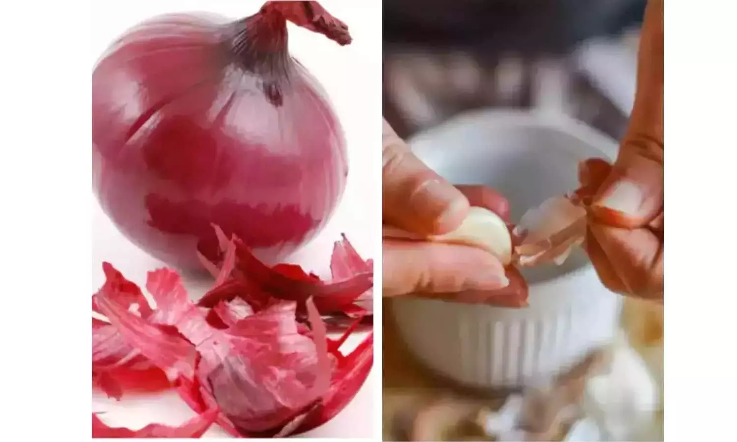 Onion Garlic Peels Benefits