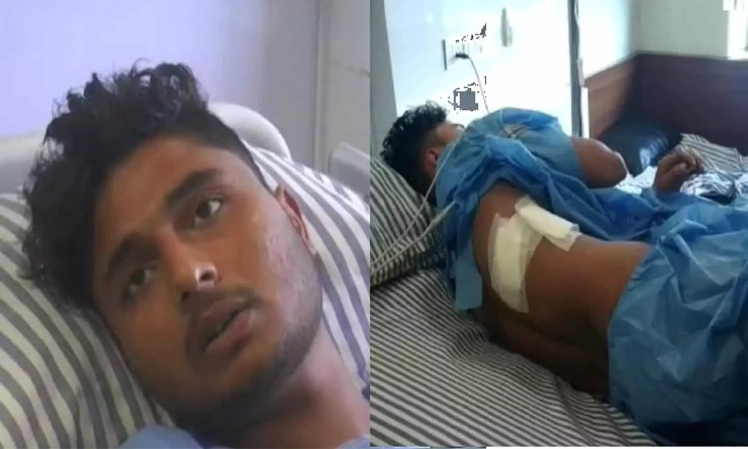Bihar: Nupur Sharma का मोबाइल पर वीडियो देख रहा था युवक, तीन बदमाशों ने मारपीट कर घोंप दिया चाकू, अब फिर मचा बवाल