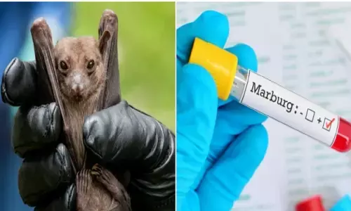 Marburg virus: चमगादड़ से इंसानों में फैला मारबर्ग वायरस! अबतक दो लोगों की मौत