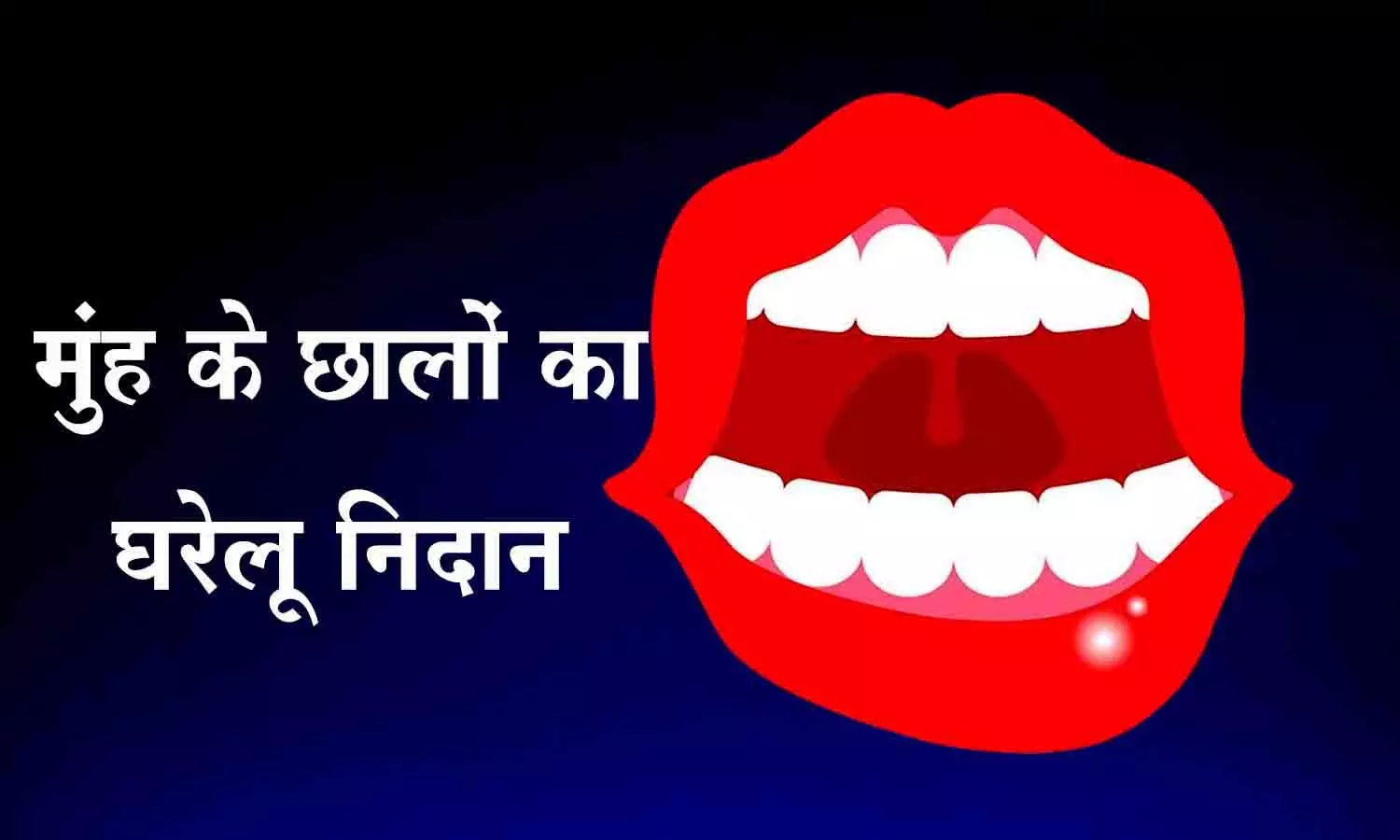 home treatment of mouth ulcers