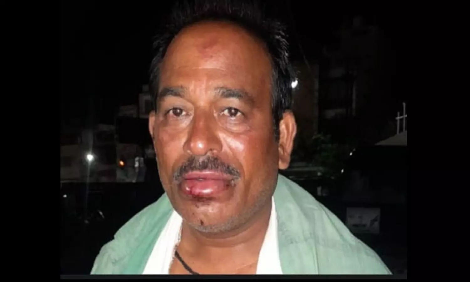 एमपी के सतना में नशेड़ियों ने ट्रक चालक को पीटा, शराब के लिए पैसे न देने का विवाद