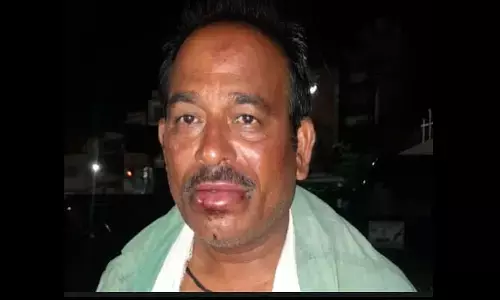 एमपी के सतना में नशेड़ियों ने ट्रक चालक को पीटा, शराब के लिए पैसे न देने का विवाद