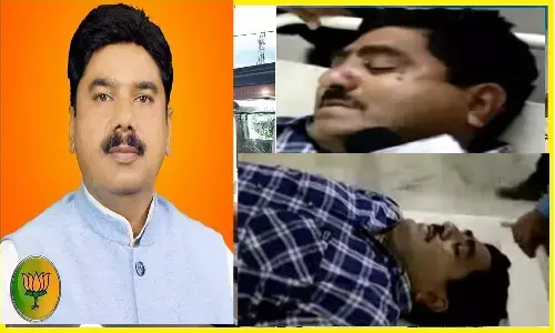 REWA: सिरमौर जनपद सीईओ ICU में भर्ती, एसके मिश्रा ने MLA केपी त्रिपाठी को हमले का जिम्मेदार बताया